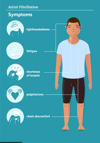 AFib symptoms illustration